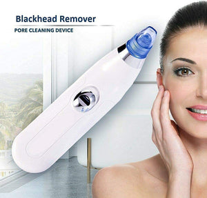 4-in-1 Blackhead Remover Vacuum – Electric Pore Cleaner with Adjustable Suction & Interchangeable Heads - Facial Device for Men & Women (Blue) (POWER CELL (AA) BATTERY INCLUDED)