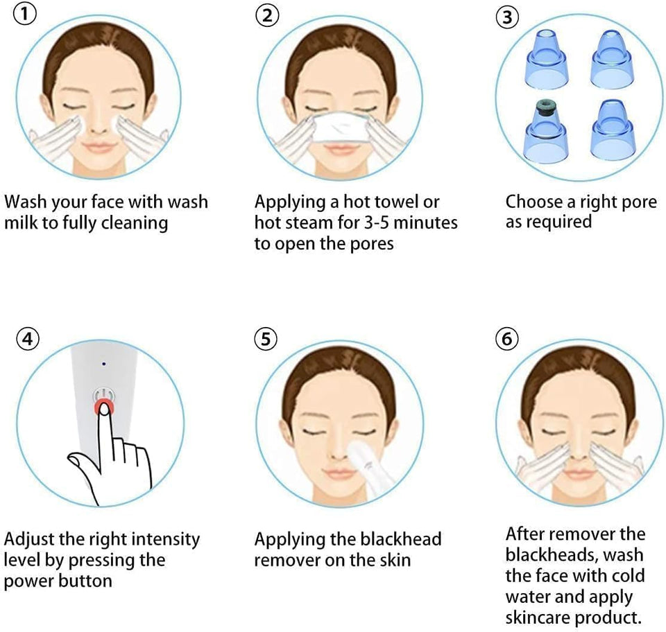 4-in-1 Blackhead Remover Vacuum – Electric Pore Cleaner with Adjustable Suction & Interchangeable Heads - Facial Device for Men & Women (Blue) (POWER CELL (AA) BATTERY INCLUDED)